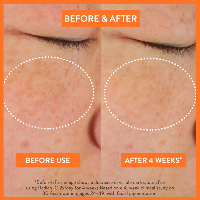 Radian C Creme - Aufhellende Creme | Wonder Skin